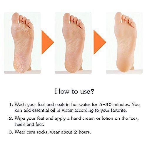 CurrentDealz™ Anti Crack Full Length Silicone Foot Protector