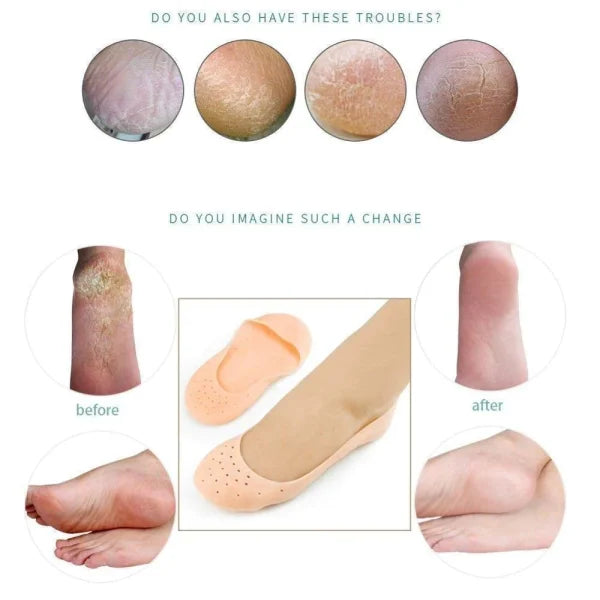CurrentDealz™ Anti Crack Full Length Silicone Foot Protector