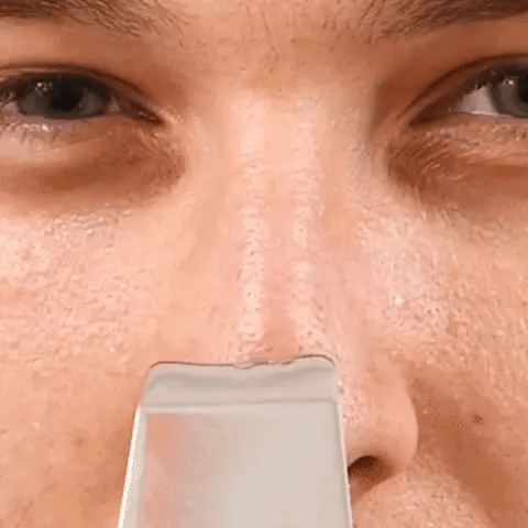 CurrentDealz™ Ultrasonic Facial Skin Scrubber