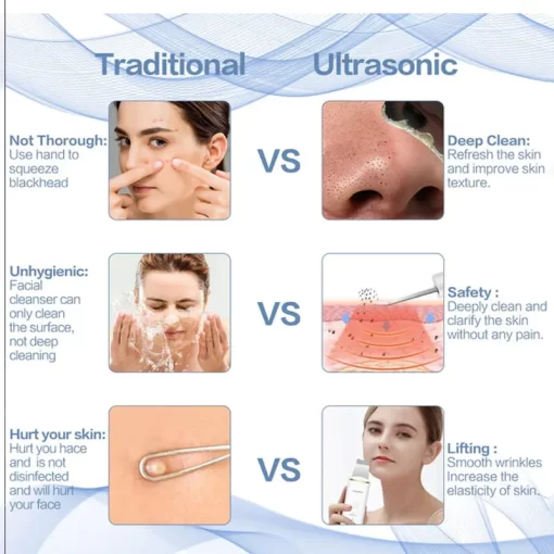 CurrentDealz™ Ultrasonic Facial Skin Scrubber