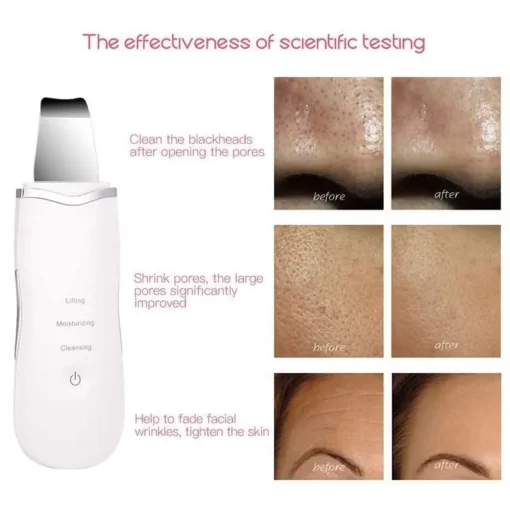 CurrentDealz™ Ultrasonic Facial Skin Scrubber
