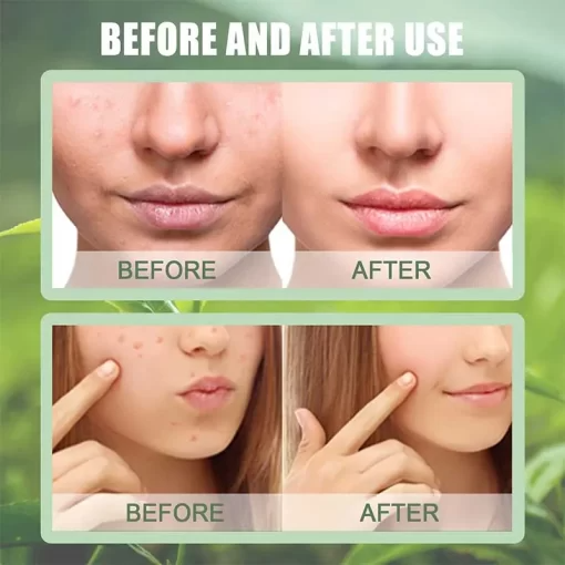 CurrentDealz™ The Magic Green Stick Mask
