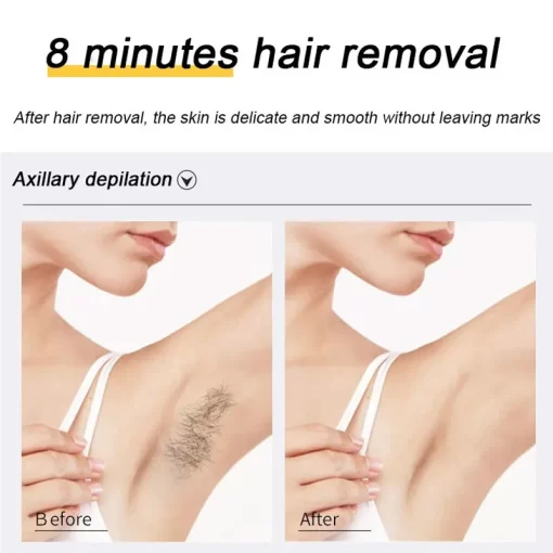 CurrentDealz™ Ecrin Hair Removal Spray